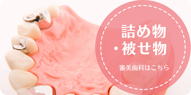 詰め物・被せ物 当院の技工士による製作で、短時間の治療が可能です